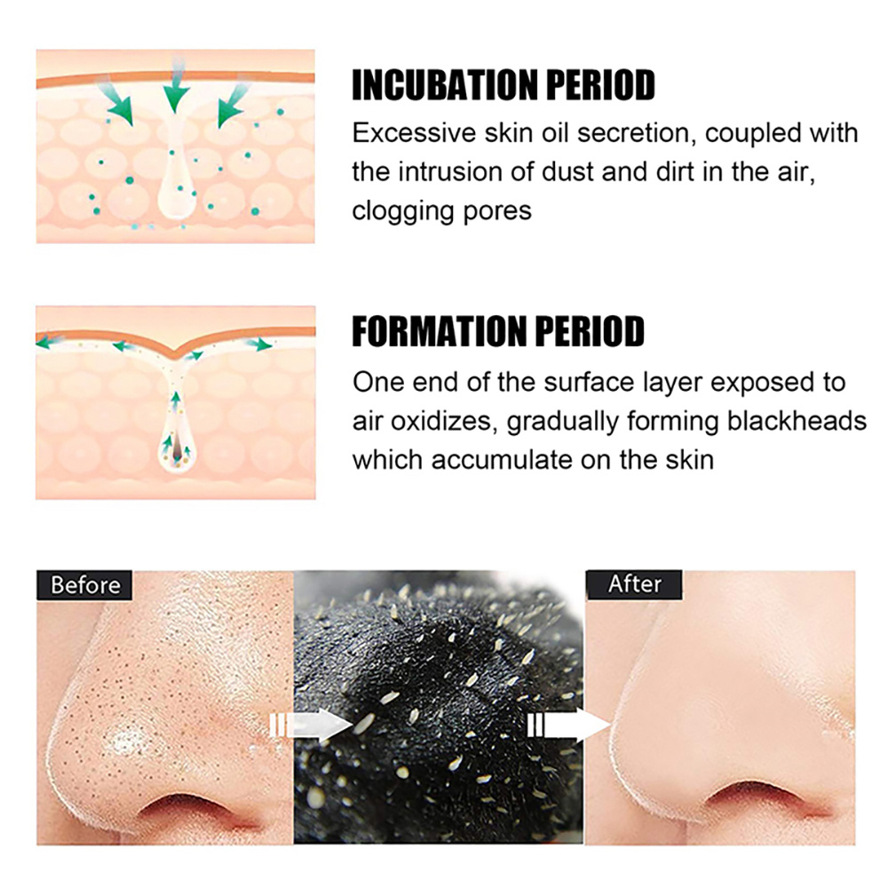 10/20/50/100PCS Nose Blackhead - Skincare Viral Tiktok 리뷰 및 가격