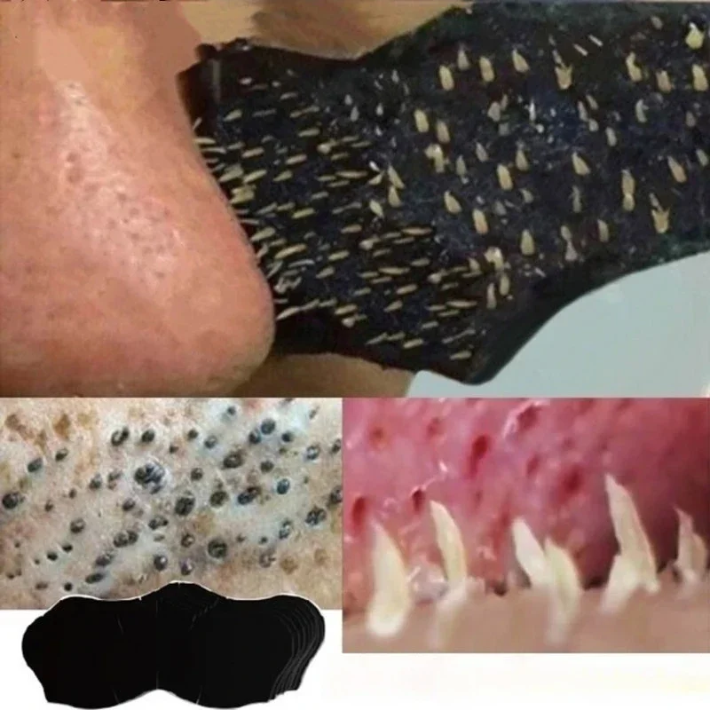 Unisex Blackhead Remove Mask N - Skincare Viral Tiktok 리뷰 및 가격