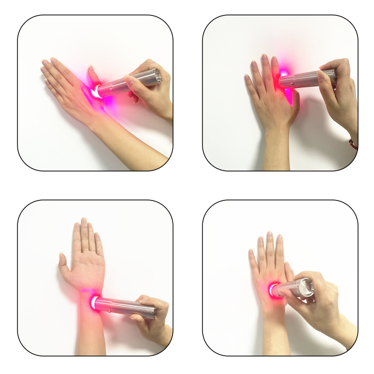 Home Facial Device Skincare Wa - Skincare You 리뷰 및 가격