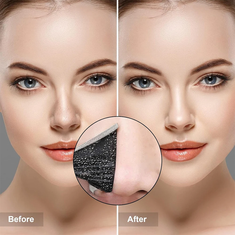 10PCS Unisex Blackhead Remove  - Skincare Viral Tiktok 리뷰 및 가격