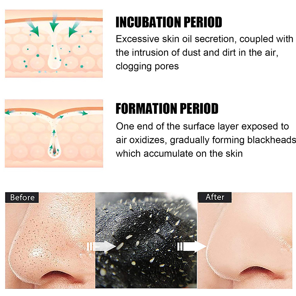 10PCS Unisex Blackhead Remove  - Skincare Viral Tiktok 리뷰 및 가격